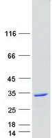 Coomassie blue staining of purified RAB27B protein