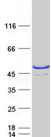 Coomassie blue staining of purified SULT2B1 protein