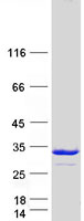 Coomassie blue staining of purified PSMD9 protein