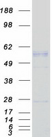 Coomassie blue staining of purified PDHX protein