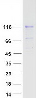 Coomassie blue staining of purified MATN2 protein