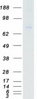 proto00418 eef2k human recombinant protein
