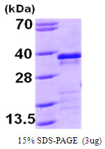 3ug by SDS-PAGE under reducing condition and visualized by coomassie blue stain