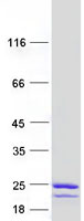 proto00762 ube2c human recombinant protein