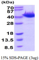 3ug by SDS-PAGE under reducing condition and visualized by coomassie blue stain