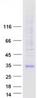 proto14520 aquaporin 7 aqp7 human recombinant protein