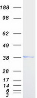Coomassie blue staining of purified TOR1A protein