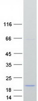 Coomassie blue staining of purified PDCD5 protein