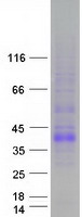 Coomassie blue staining of purified TNFSF11 protein