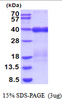 3ug by SDS-PAGE under reducing condition and visualized by coomassie blue stain.