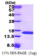 3ug by SDS-PAGE under reducing condition and visualized by coomassie blue stain.