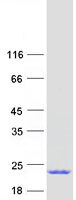 proto14933 ube2l6 human recombinant protein