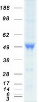 Coomassie blue staining of purified CASQ2 protein