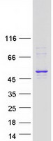 proto14965 aurora a aurka human recombinant protein