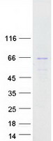 Coomassie blue staining of purified PIP5K1B protein