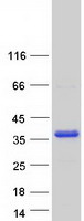 Coomassie blue staining of purified MAST4 protein