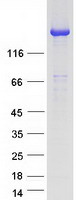 Coomassie blue staining of purified SYNJ2 protein