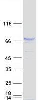 Coomassie blue staining of purified SNPH protein
