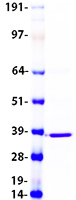 proto15121 degs1 human recombinant protein
