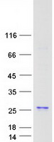 Coomassie blue staining of purified ARPC3 protein