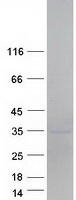 Coomassie blue staining of purified LDLRAD4 protein