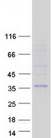 proto15194 ctdspl human recombinant protein