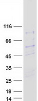 proto15304 siva siva1 human recombinant protein