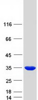 proto15305 pmm2 human recombinant protein