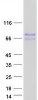Coomassie blue staining of purified MID1 protein