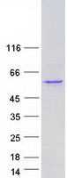 Coomassie blue staining of purified TP73 protein