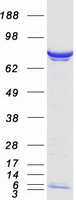 Coomassie blue staining of purified PPM1G protein