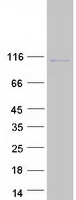 Coomassie blue staining of purified NVL protein
