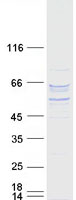 Coomassie blue staining of purified P4HA2 protein