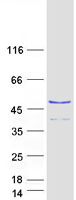 Coomassie blue staining of purified RNF113A protein