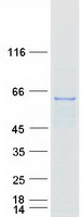 Coomassie blue staining of purified RNMT protein