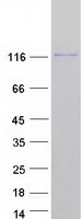 proto43295 srgap3 human recombinant protein