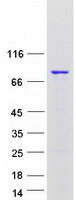 Coomassie blue staining of purified HNRNPR protein
