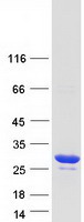 Coomassie blue staining of purified TPD52L2 protein