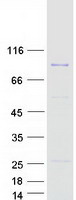 Coomassie blue staining of purified THAP12 protein