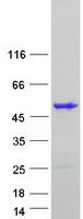 Coomassie blue staining of purified TBX1 protein