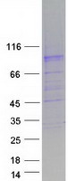 Coomassie blue staining of purified SLC26A4 protein