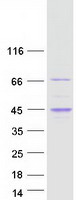 Coomassie blue staining of purified RGS14 protein