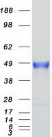 Coomassie blue staining of purified CA12 protein