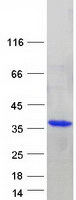 Coomassie blue staining of purified DENR protein
