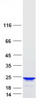 Coomassie blue staining of purified RGS10 protein