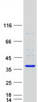 proto43704 sult1b1 human recombinant protein