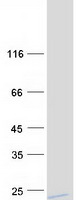 proto43708 gstz1 human recombinant protein