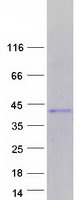 Coomassie blue staining of purified TLX3 protein
