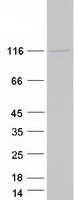 Coomassie blue staining of purified DHX16 protein