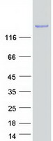 proto60271 jlp spag9 human recombinant protein